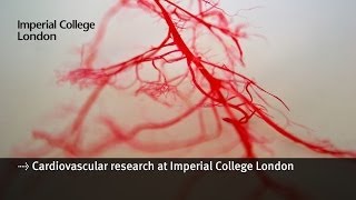 Cardiovascular research at Imperial College London [upl. by Kylynn]