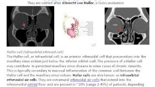 Haller cell [upl. by Margaretta486]