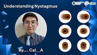 Understanding Nystagmus by KL  May 21st 2024 [upl. by Freemon]