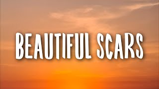 Maximillian  Beautiful Scars Lyrics [upl. by Sinnek]