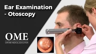 Otoscopy Ear Examination  ENT [upl. by Sidky]