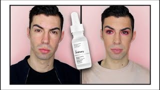 The Ordinary Salicylic Acid UPDATE 5 Months [upl. by Antoinetta]