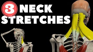 Neck Stretches for Instant pain relief [upl. by Llerej]