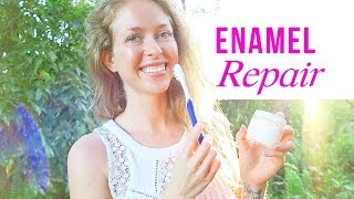 How I Naturally Restored My Enamel and Remineralized My Teeth [upl. by Toinette656]