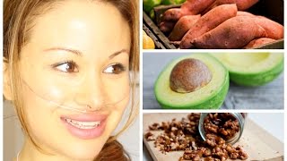 Easy Vegan Breakfast Sweet Potato  Avocado  Pulmonary Hypertension [upl. by Shirlee449]