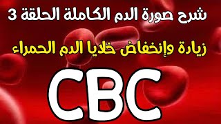 CBC 3 Erythrocytosis vs Erythropenia [upl. by Aetnuahs565]