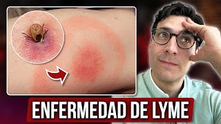 ¡Cuidado con la Enfermedad de Lyme  Prevención Causas y Tratamientos [upl. by Auod]