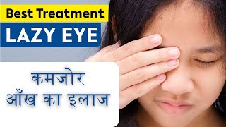 Lazy Eye Amblyopia Symptoms Causes amp Treatment कमजोर आँख का सही इलाज  Exercises for Lazy eye [upl. by Dori257]