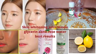 glycerine and rose water for skin whitening  glycerin for skin whitening su beauty and remedies [upl. by Danzig233]