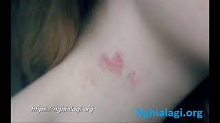 Hickey là gì Những ý nghĩa của Hickey Nghialagiorg [upl. by Debera214]