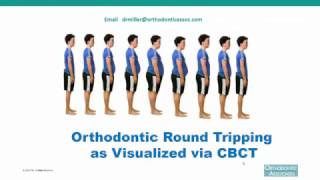 Orthodontic Round Tripping as Visualized via CBCT [upl. by Brouwer]