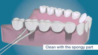 Clean around your dental implants with TePe Bridge amp Implant Floss [upl. by Galitea]