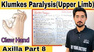 Klumkes Paralysis Brachial Plexus Clinical Klumpke Paralysis Brachial Plexus Clinical Anatomy [upl. by Atelahs]