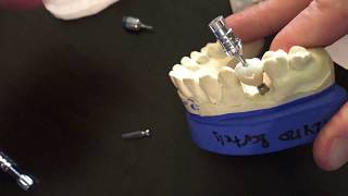 Restoring Neodent implant level impressions [upl. by Athene494]