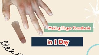 making Finger prosthesis  index finger lost  prosthesis  Custom finger prosthesis [upl. by Elahcar20]