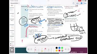 Anterior inferior cerebral artery stroke neurology 76  First Aid USMLE Step 1 in UrduHindi [upl. by Aeli]