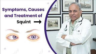 Unlocking the Mystery of Squint  Discover Causes Treatments and Hope  Sanjeevan [upl. by Laoj]