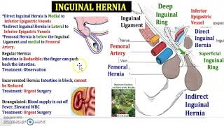 What is the Hesselbach triangle and direct inguinal hernia Femoral Crural Groin USMLE NCLEX MCAT [upl. by Adriena]