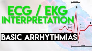 Basic Arrhythmias  Sinus Brady Tachy Premature Beats  ECG EKG Interpretation Part 3 [upl. by Kremer]