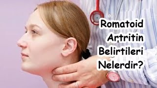 Romatoid Artritin Belirtileri Nelerdir [upl. by Meeks]