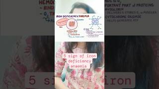 5 sign of iron deficiency anaemia on skin nails and hair irondeficiencyanaemia heathvideos [upl. by Anole783]