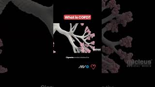 Chronic Obstructive Pulmonary Disease COPD 🫁 [upl. by Torrey729]