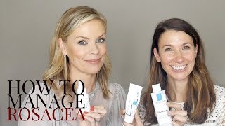 How to manage Rosacea with Rosie Green [upl. by Thurstan]