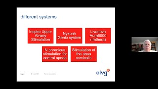 Sleep surgery in OSA – Inspire upper airway stimulation [upl. by Bristow]