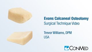 Dr Trevor Williams  Evans Calcaneal Osteotomy  CONMED Surgical Technique [upl. by Reinald]