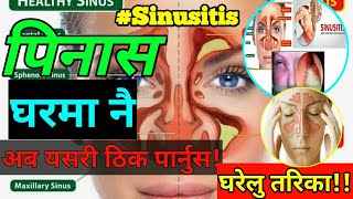 Sinusitis Symptoms Causes Duration amp Treatmentपिनासको घरेलु उपचार मात्रै यती काम गर्नुस [upl. by Latvina]