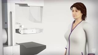 Mammogram for Breast Cancer  What to Expect [upl. by Yemaj]