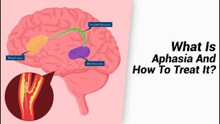 What Is Aphasia And How To Treat It [upl. by Marka]