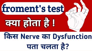 froments sign  froments test  froment sign  Physio Talk [upl. by Anabahs]