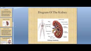 Medullary Sponge Kidney Presentation [upl. by Darn526]