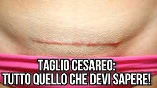 Taglio cesareo programmato tutto quello che devi sapere \clamoroby\ parto cesareo programmato [upl. by Llewkcor751]