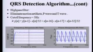 ECG Analysis 1 QRS Detection [upl. by Augusta8]