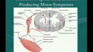 Clinical Significance of Demyelinating Lesions of the Central Nervous System [upl. by Naerad923]