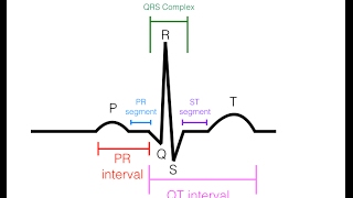 EKGECG Interpretation Basic  Easy and Simple [upl. by Senecal]