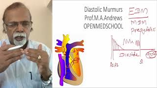 Auscultation diastolic murmurs basics [upl. by Augustine710]