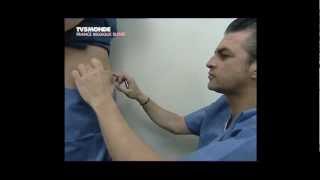 Lipolyse de labdomen par le Docteur Thierry LAFITTE TV5 Mondemp4 [upl. by Ennayelsel954]