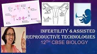 What are Assisted Reproductive Technologies IVFZIFTGIFTArtificialinsemination12thCBSEBiology [upl. by Aicilas]