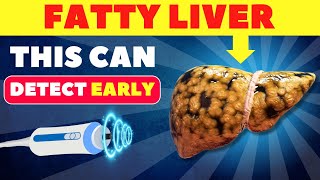 The Best 3 Tests to Detect Fatty Liver Early  Fatty Liver fattyliver health [upl. by Behlau]