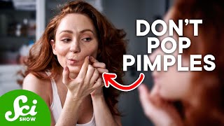 How to Get Rid of Acne For Good—According to Science [upl. by Normy]