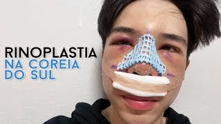 Fiz uma cirurgia plástica na Coreia do Sul  Vlog [upl. by Massiw]