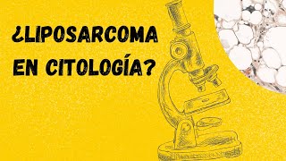 LIPOSARCOMA Diagnóstico citológico Tumores de partes blandas [upl. by Cathe848]