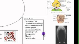 Calcium Homeostasis Part 2 [upl. by Buddie]