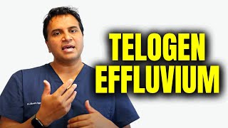 Telogen Effluvium Hair Loss [upl. by Weismann]