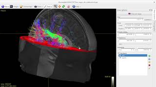 Tractography of arcuate fasciculus using MRtrix3 [upl. by Lumpkin]