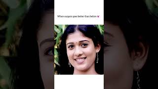 When surgery goes better than before 💕🔥NayantharaShortsTrending [upl. by Atolrac]