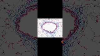 Massons Trichrome staining [upl. by Herwick]